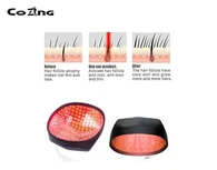 लेजर हेयर रिस्टोरेशन कैप